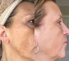 Theres just something about feelint confident in your skin again ✨ bonus if  your hair is growing and thriving too right?🥹 say DEETS ive got a suprise  👇🏻