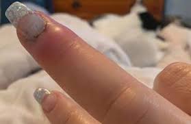 If your nails feel weak after you take off the acrylics, it's likely they will break, which can be painful and result in jagged edges.1 cut your nails straight across with a pair of clean nail clippers. Woman Nearly Lost Her Finger When A Little Red Bump Turned Into A Flesh Rotting Infection After A Trip To The Nail Salon