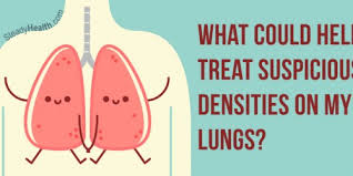 Maybe you would like to learn more about one of these? Chest X Ray Shows Suspicious Densities On Lungs What Could That Mean Respiratory Tract Disorders And Diseases Articles Body Health Conditions Center Steadyhealth Com