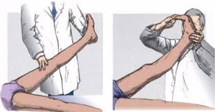 Image result for Crossed-Leg Test