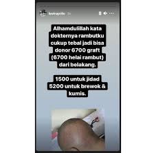 We did not find results for: Lakukan Transplantasi Rambut Di Turki Penampilan Terbaru Kevin Aprilio Sukses Bikin Pangling Kepala Plontos Hingga Tumbuh Brewok Semua Halaman Hype