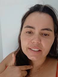 Dia 3 em Recuperação: Desabafos de Saúde