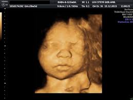 Schwangerschaftswoche die infos über die entwicklung & größe eures babys inkl. 3d 4d Ultraschall Pranataldiaknostik