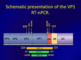 Image result for CSF PCR