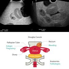 Check spelling or type a new query. Female Pelvic Ultrasound Phantom For Gynecology Kyoto Kagaku