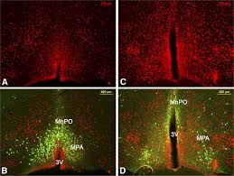 Leptin-Receptor-Expressing Neurons in the Dorsomedial Hypothalamus and  Median Preoptic Area Regulate Sympathetic Brown Adipose Tissue Circuits