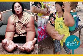Mais cette américaine ne veut pas s'arrêter là. A La Decouverte De La Femme Aux Plus Gros Bras Du Monde Abidjanshow Com