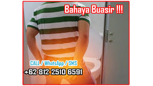 Buy stomcare penawar ubat buasir, berak berdarah (hemorrhoids) online at lazada. Inilah Ubat Tradisional Berak Berdarah Sembuhkan Buasir