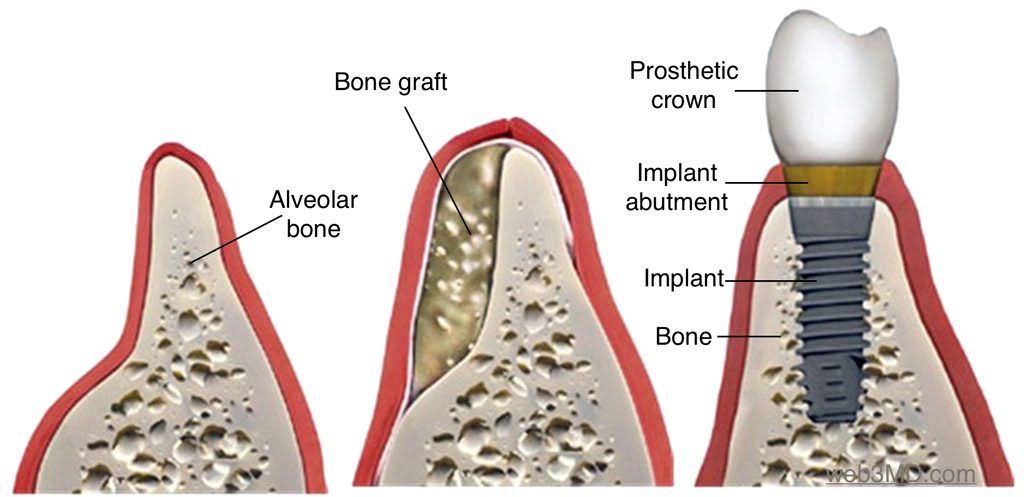 Dental Implants & Periodontist product image