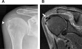 Image result for Shoulder Imaging