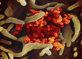 تحليل الحمض النووي rna لفيروس سي: Everything You Need To Know About Pcr Analysis Testing For Coronavirus Egypt Independent