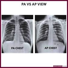 Chest X Ray Chest Radiography Nurse Study Guide Nursing Study Guide Nursing Study Radiography