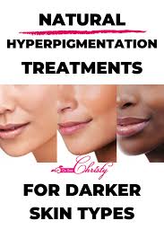 Medium skin colour may find following treatment. Pin On Skin