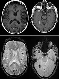 The Pan African Medical Journal Image Quiz