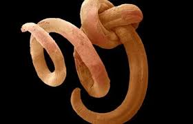 Image result for Pinworm