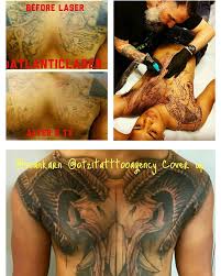 #gufetto #gufettotattoo #inktattoo #tattooart #bodytattoo #tattoostyle #italytattooo #cologne #otzitattoobrescia. Atlantic Laser Tattoo Removal An Amazing Cover Up By Sean Karn At Otzi Tattoo Agency For One Of Our Clients After 3 Treatments Our Client Was Able To Get The Chest
