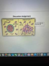 Early warning signs of cancer in children models for early 7 you shouldn't ignore rediff get ahead. Solved Po Des Assignment Due 5 12 21 Questions From Chapt Chegg Com