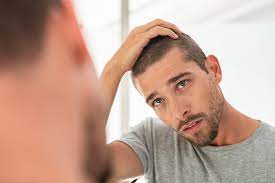 Welche produkte, mittel und shampoo sind am besten? Haartransplantation Bei Geheimratsecken Adonis Magazin