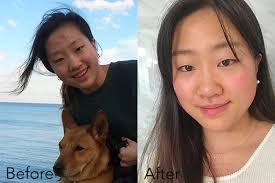 Da vừa mụn vừa thâm nhưng nhờ đến 5 sản phẩm sau, cô nàng đã có được làn da  không tỳ vết đáng ao ước