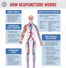 It S An Amazing Modality Courtney Somers Acupuncture Facebook