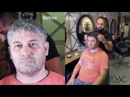 Zenix Siyah Sampuan Uygulamasi Beyaz Saclar Icin Www Kuafordepo Com Youtube