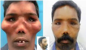 ZASK Dental Insignia