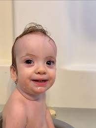 Ellie's Emergency Knee Surgery and Recovery Update