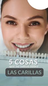 Te contamos las 5 cosas que desconocías sobre las ✨carillas dentales✨, 1.  Su grosor es tan fino que incluso es posible colocarlas sin tallar el  diente 👌, 2. Es fundamental tener la 👄boca en salud ...