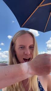 this tan line has not completely gone away in 5 years #applewatch #tan  #kachow #foryou #lake #sun