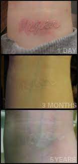 Fyeahtattoos Com White Tattoo Tattoos White Ink Tattoo