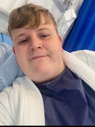 Gastric Sleeve Before and After in Men