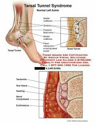 Pin On Medical