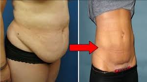 Pin On Pregnancy