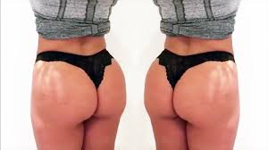 It is said that jennifer lopez has done for the rear end what pamela anderson has done for the front end and over the last few years the buttocks have received more press coverage than ever before. Brazilian Butt Lift Brasilianische Po Youtube
