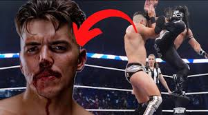 New Year, New BORKEN NOSE!