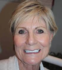 Veneers & Lumineers Sacramento, CA