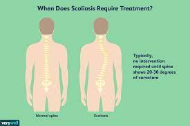 Find out what we tell them and how it applies to you. Scoliosis Overview And More