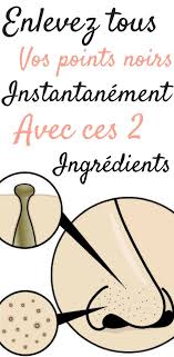 Epingle Sur Remedes Rides