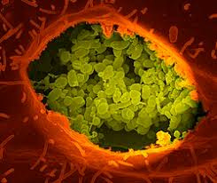 Image result for Micrargeriella