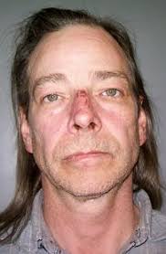 Crime Watch: Storm Lake, Iowa, man arrested after tumble down stairs