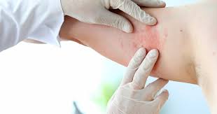 Products and services are provided by horizon blue cross blue shield of new jersey, horizon insurance company, horizon healthcare of new jersey, braven health, and/or horizon healthcare dental, inc., each an independent licensee of the blue cross blue shield association. Patients With Medicaid May Have Difficulty Scheduling Dermatology Appointments