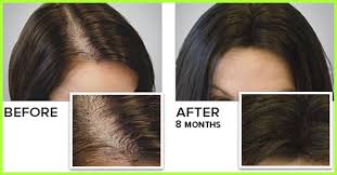 More often than not, dryness is the only reason for hair to drop. How Can I Grow My Hair Faster 5 Essential Vitamins 2 Minerals And Other Nutrients That May Improve Hair Growth