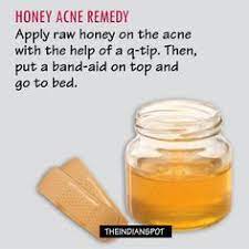 Before you work on treating your pimples, it pays to know what causes the unsightly spots. 21 Best Overnight Pimple Remedies Ideas Overnight Pimple Remedies Pimples Remedies Beauty Remedies