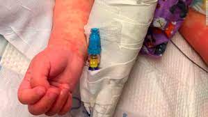 Download the perfect crash pictures. Mis C Kids With Coronavirus Related Inflammatory Syndrome Need Help Fast Cnn