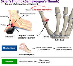 View More Teaching Images And Get Your Free Trial At Roshreview Com Medical Knowledge Hand Surgery Human Anatomy And Physiology