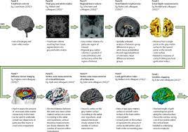 Aop, abeka, bju press & more. Neuroimaging In Autism Spectrum Disorder Brain Structure And Function Across The Lifespan The Lancet Neurology
