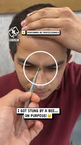 Getting stung by a bee