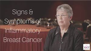 Another symptom of inflammatory breast cancer is when your breast skin turns pink or reddish on more than half the breast—something that can be hard to tell in those with darker skin tones. What Are The Symptoms Of Inflammatory Breast Cancer Youtube