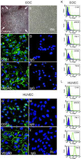 Any student not finished by the end of the 160 minutes may continue. Proapoptotic Antimigratory Antiproliferative And Antiangiogenic Effects Of Commercial C Reactive Protein On Various Human Endothelial Cell Types In Vitro Circulation Research