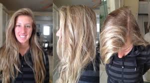 Lessen breakage, which can reduce thinning. Amanda Post Weight Hair Loss Treatment
